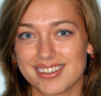smiling North Shore Dental patient
