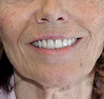 smiling North Shore Dental patient