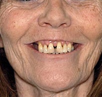 smiling North Shore Dental patient