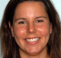 smiling North Shore Dental patient