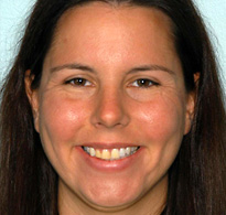 smiling North Shore Dental patient
