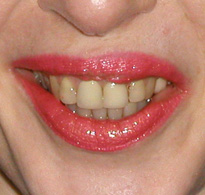 smiling North Shore Dental patient