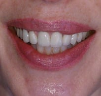 smiling North Shore Dental patient