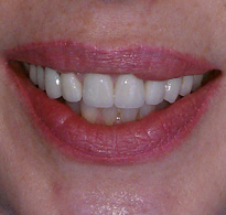 smiling North Shore Dental patient