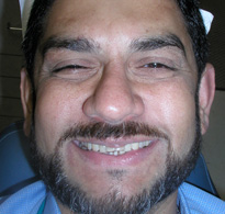 smiling North Shore Dental patient