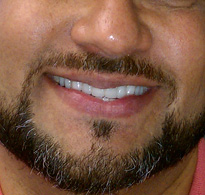 smiling North Shore Dental patient