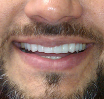 smiling North Shore Dental patient
