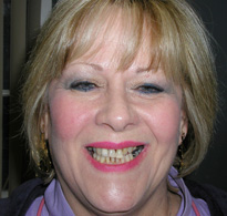 smiling North Shore Dental patient