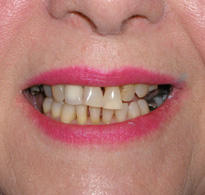 smiling North Shore Dental patient
