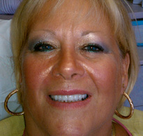 smiling North Shore Dental patient