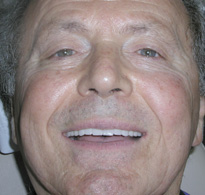 smiling North Shore Dental patient