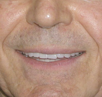 smiling North Shore Dental patient