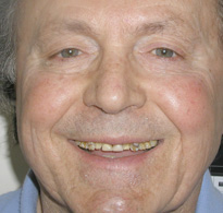 smiling North Shore Dental patient