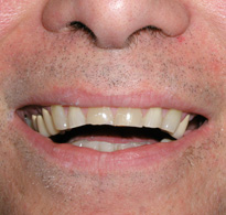 smiling North Shore Dental patient