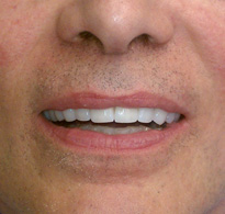 smiling North Shore Dental patient