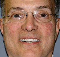 smiling North Shore Dental patient