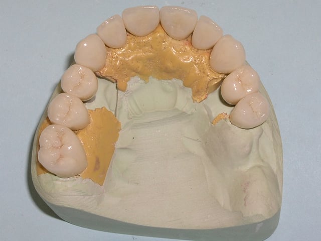 tooth model