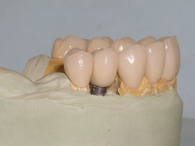 tooth model