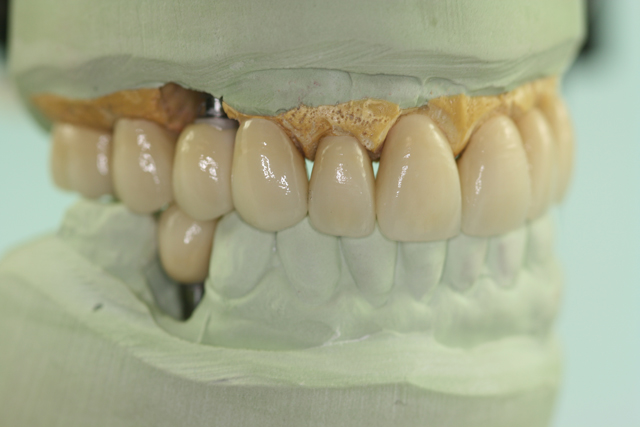 tooth model