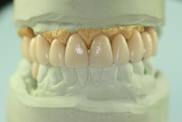 tooth model