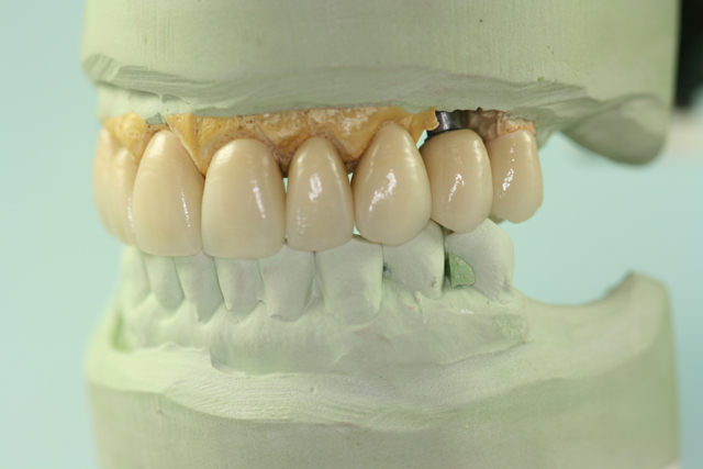 tooth model