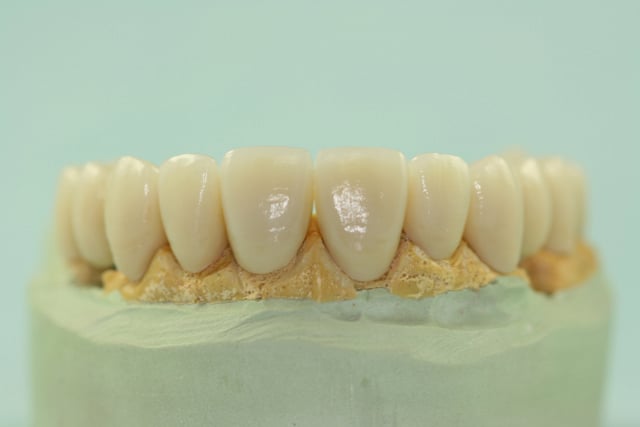 tooth model