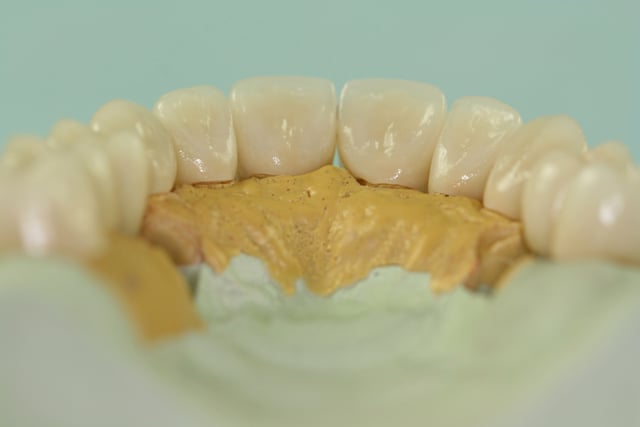tooth model