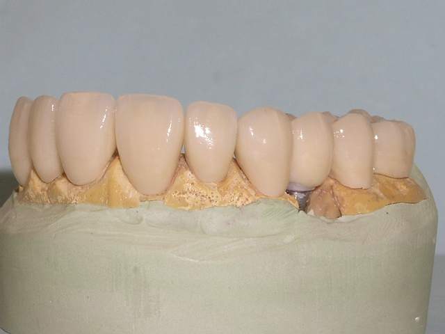 tooth model