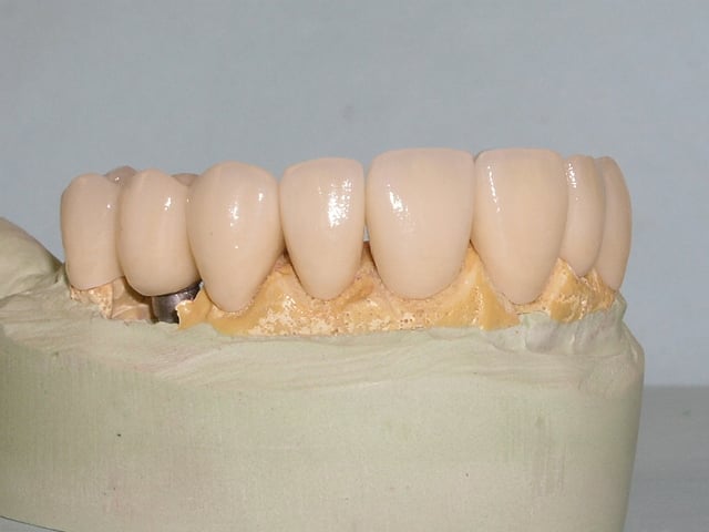 tooth model