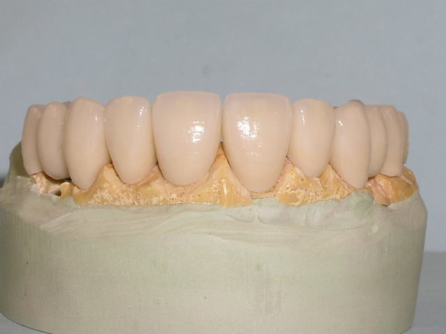 tooth model