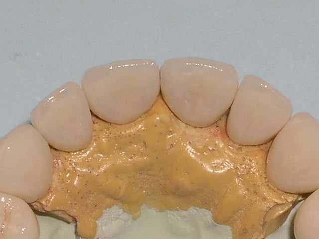 tooth model