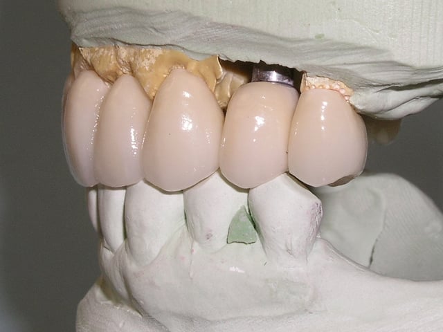 tooth model