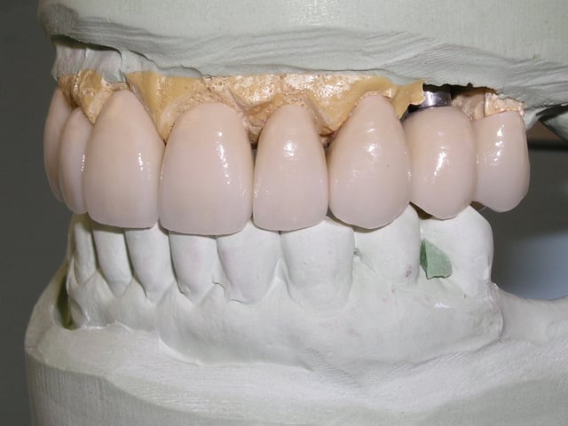 tooth model