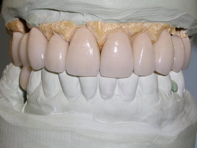 tooth model