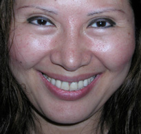 smiling North Shore Dental patient