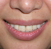 smiling North Shore Dental patient