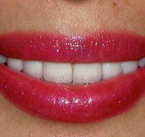 smiling North Shore Dental patient