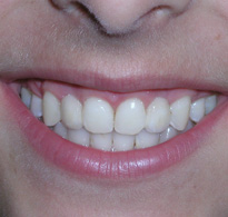 smiling North Shore Dental patient