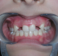 smiling North Shore Dental patient