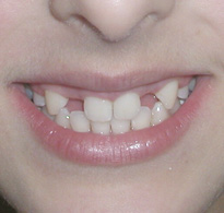 smiling North Shore Dental patient