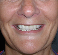 smiling North Shore Dental patient