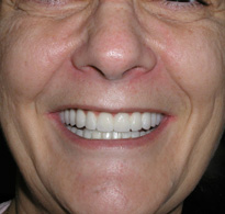 smiling North Shore Dental patient