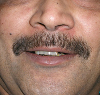 smiling North Shore Dental patient