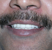 smiling North Shore Dental patient
