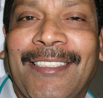 smiling North Shore Dental patient