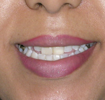 smiling North Shore Dental patient