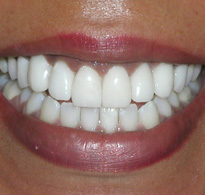 smiling North Shore Dental patient