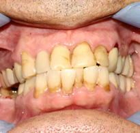 smiling North Shore Dental patient