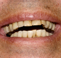 smiling North Shore Dental patient