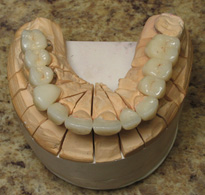 teeth model